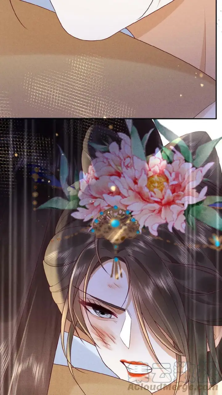 《娇娇贵妃手段高，皇帝不经撩》第78话 重伤图31